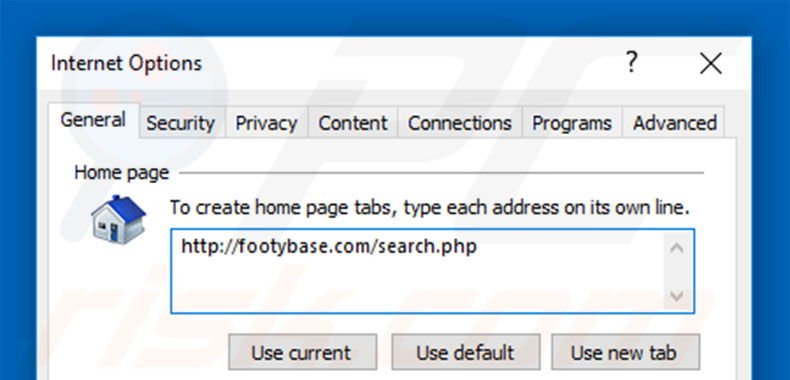 Removing footybase.com from Internet Explorer homepage